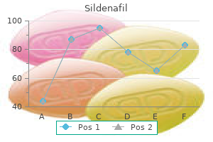 order sildenafil 50 mg amex